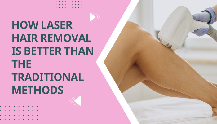 laser hair removal