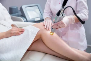 Laser hair removal treatment in ajman at bliss clinic