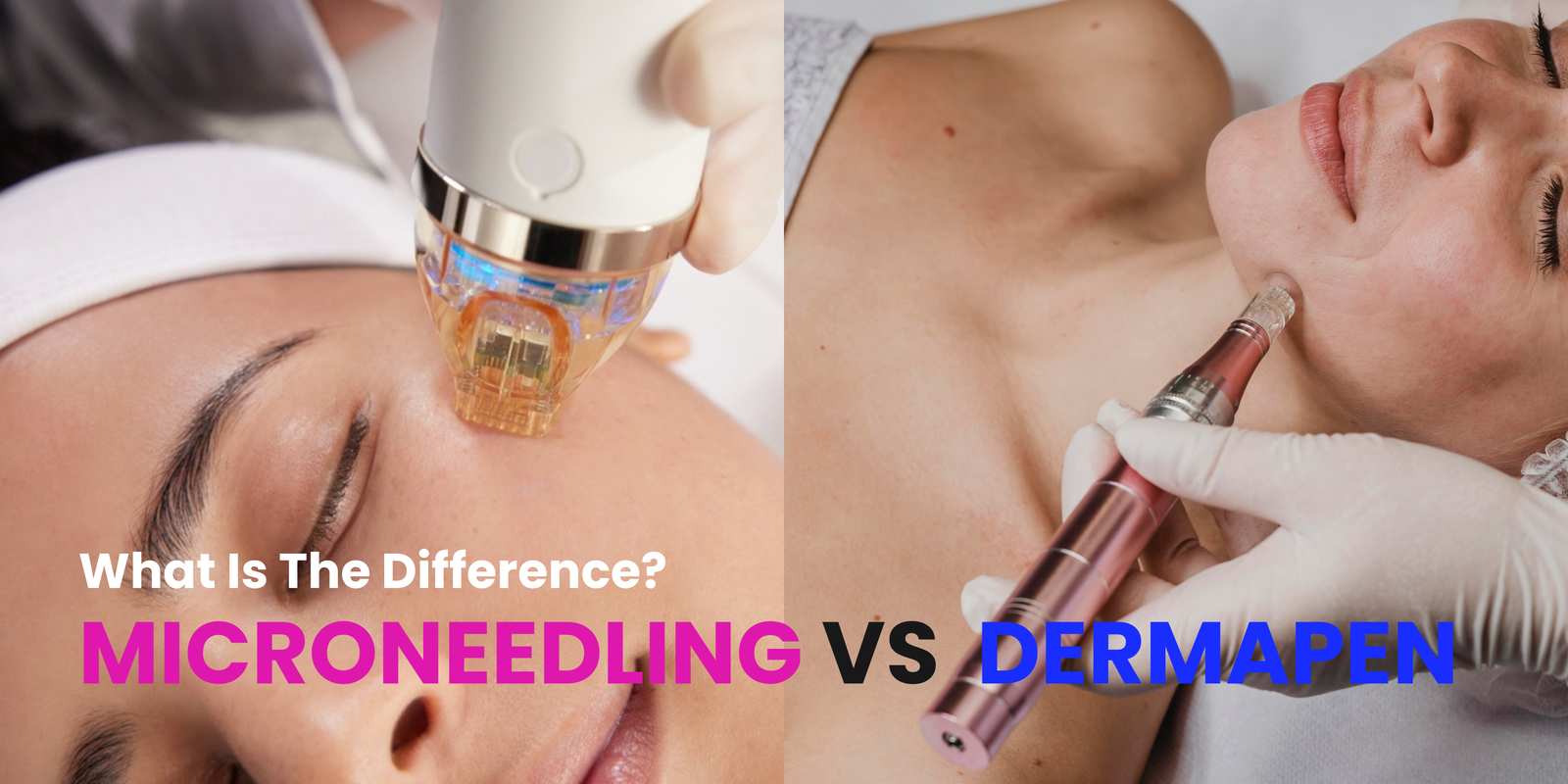 what is the difference between microneedling and dermapen treatments?