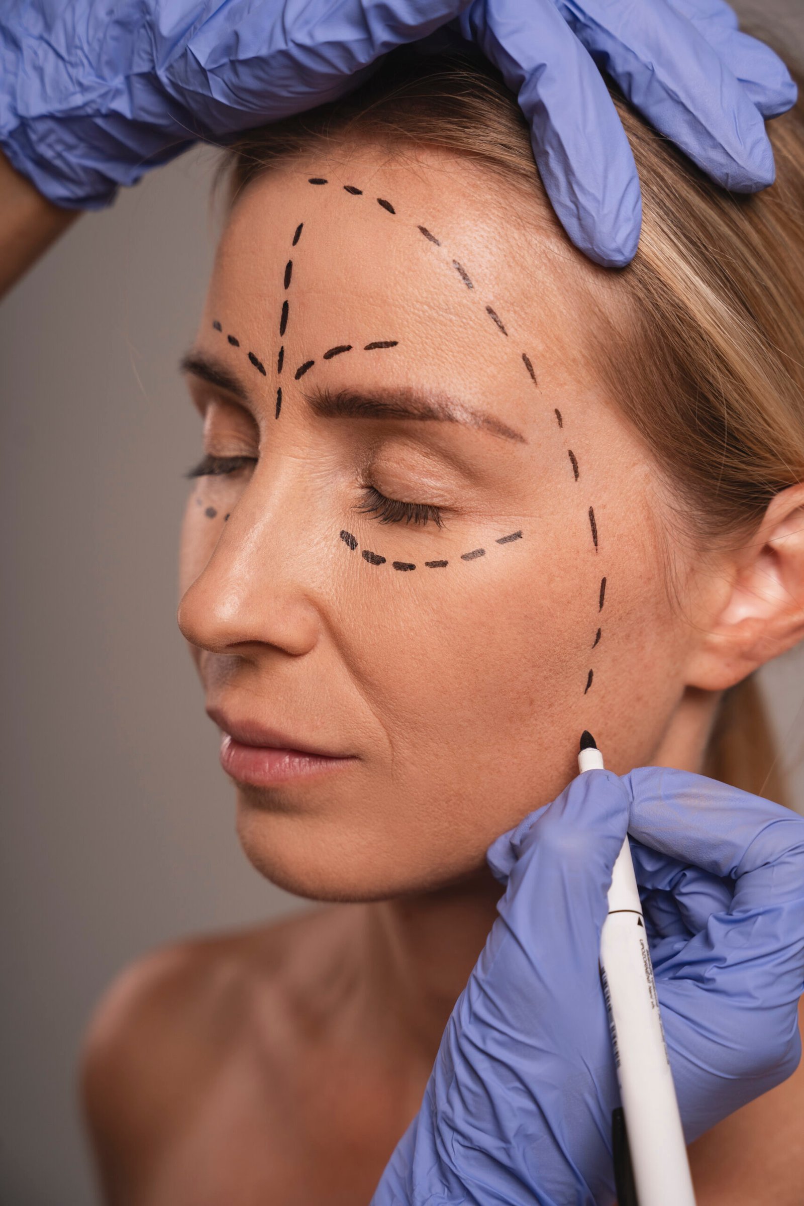 woman preparing cosmetic surgery scaled