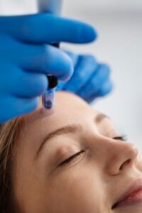 patient undergoing microneedling procedure