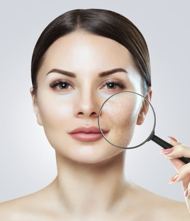 Woman showing visible skin improvement after skin rejuvenation treatment