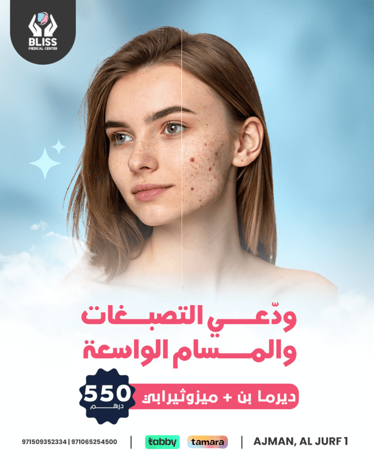 ودّعــــــي التصبــــغات