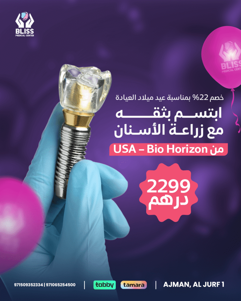 Offer on USA Bio Horizon Dental Implants at Bliss Medical Center, the best clinic in Ajman for confident smiles.
