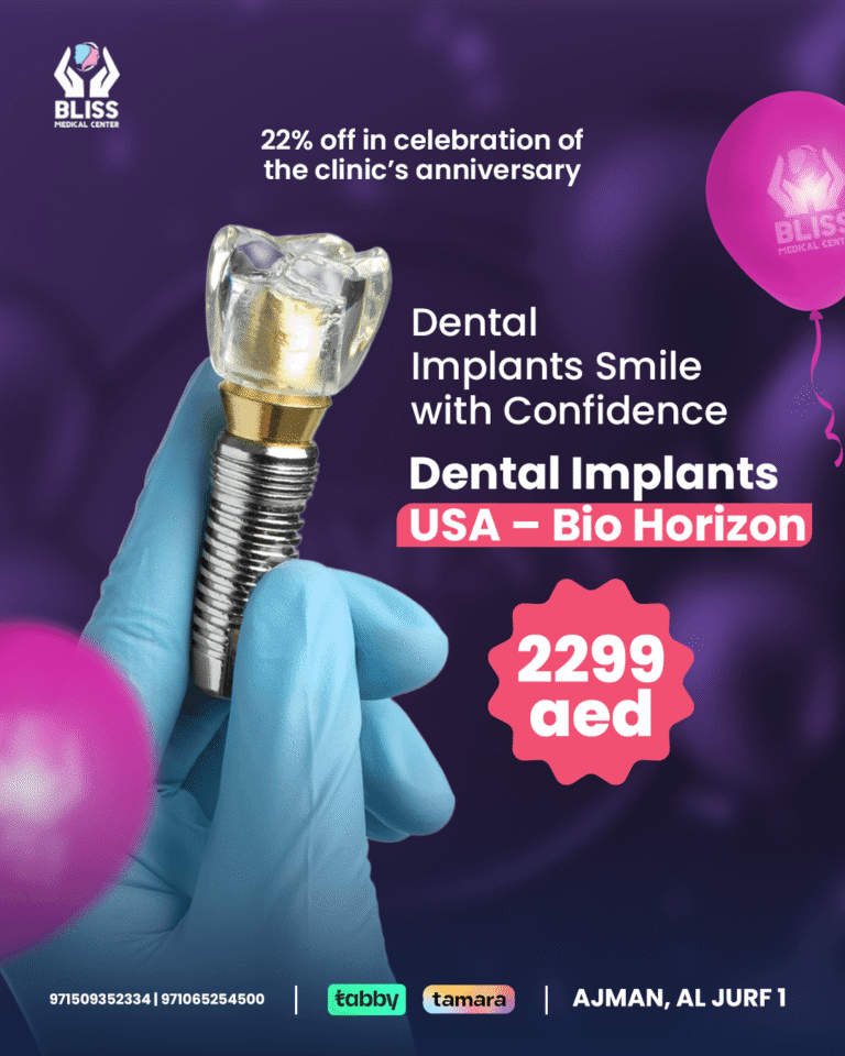 Offer on USA Bio Horizon Dental Implants at Bliss Medical Center, the best clinic in Ajman for confident smiles.