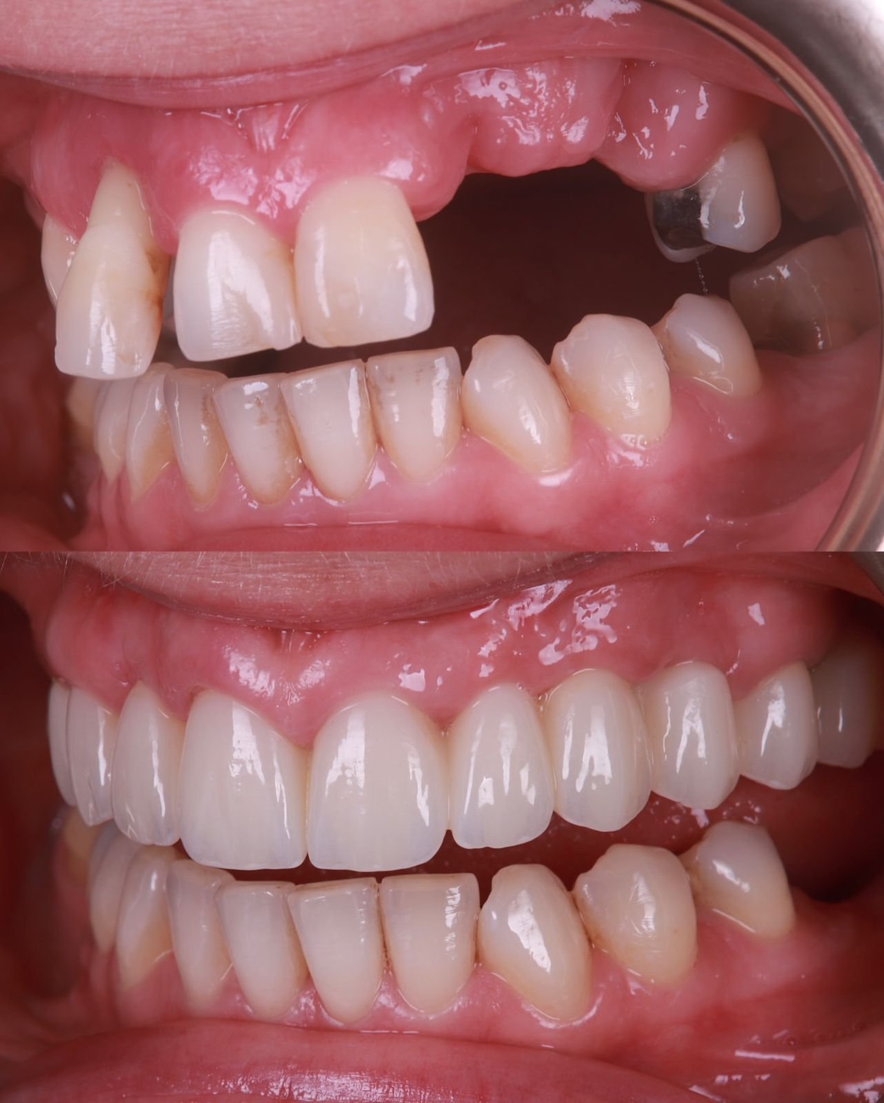 Dental patient smile result 2