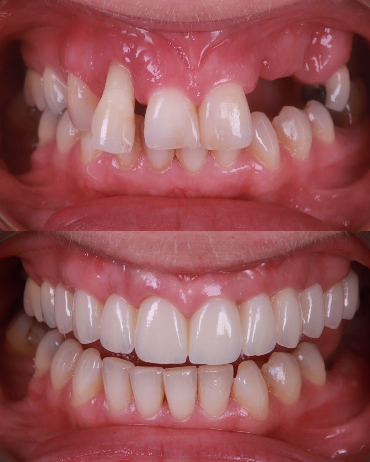 Dental patient smile result 4
